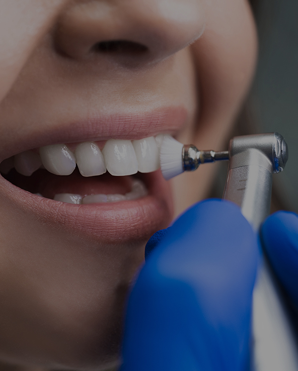 Treatment - Novo Dental Practice